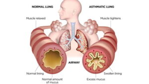 olej CBD a astma
